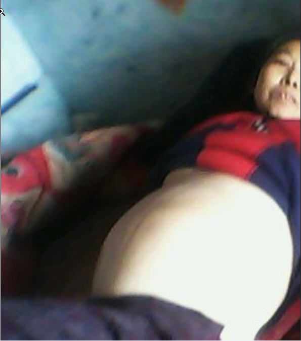 劉德清最後被迫害得腹部腫脹，像懷孕七、八個月的孕婦一樣（圖片來源：明慧網）