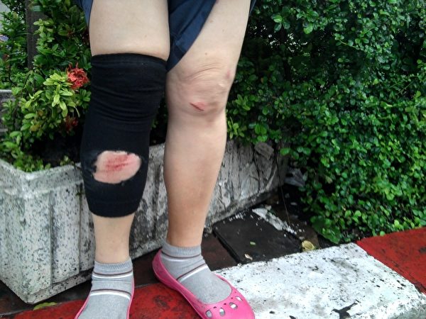 在去年的8月中旬，林太太在同一地点横幅下的马路边打坐，遭一辆出租车的蓄意冲撞，人被撞出好几米远，她的双腿被撞伤。（当事人提供）  