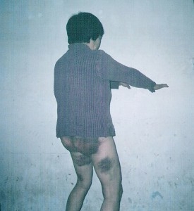 法輪功女學員劉季芝遭河北公安毒打並姦污，臀部、腿部多處外傷 。(明慧網)
