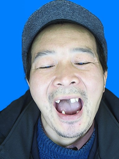 呂松明遭酷刑迫害牙齒只剩下六個（圖片來源：明慧網）