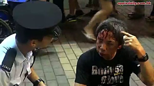 6日晚上，為法輪功仗義執言的陳先生遭暴徒毆打得頭破血流的情況。（網絡圖片）