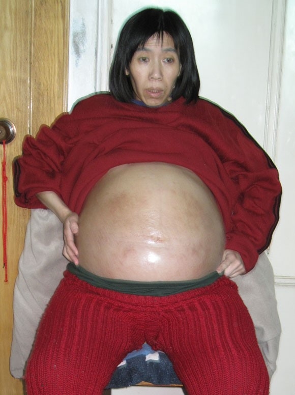 瀋陽市法輪功學員吳樹艷被劫持到遼寧省女子監獄，曾被單獨關押3年、每天12小時奴工迫害。以致腹水症狀加重，開始不能躺下睡覺，每天只能坐著，整天無法入睡。（明慧網）
