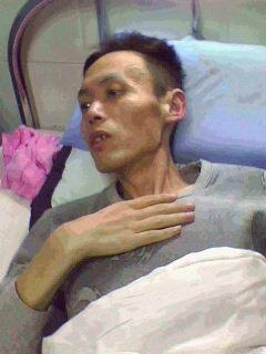 被迫害後的李上榮在醫院，檢查結果顯示肺部已經爛沒了。（明慧網）