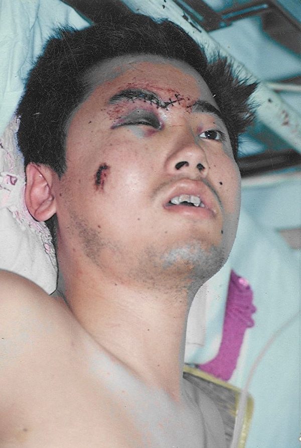 张慧东遭受中共迫害，被迫从五楼跳下致残，图为摔伤严重的张慧东在医院。（图片提供：张慧东）