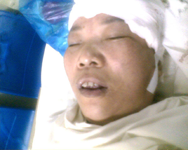 陳玉梅被警察打成重傷後在醫院的照片（明慧網）
