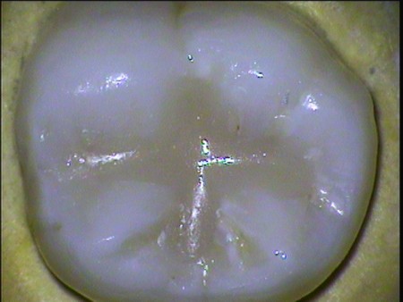 通过世界最先进手术显微镜，可以放大倍数更精确的诊治牙疾。（图由该诊所提供）