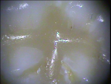 通过世界最先进手术显微镜，可以放大倍数更精确的诊治牙疾。（图由该诊所提供）