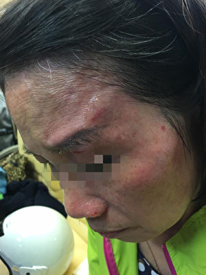 陆客台湾夜市玩空拍机 砸伤议员母亲