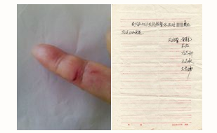 左為龐繼紅被割開的手指傷口，右為參與抽血的警察簽名（明慧網）