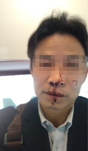 1月12日，广东中山市三乡镇侨兴花园附近，一名男子遭两名蒙面大汉袭击。（受访者提供）