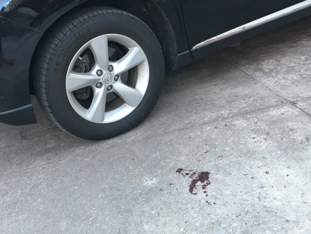 在后院的停车位旁边，可以清晰看到有血迹。